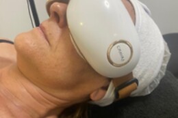 OREA ESTÉTICA AVANZADA
